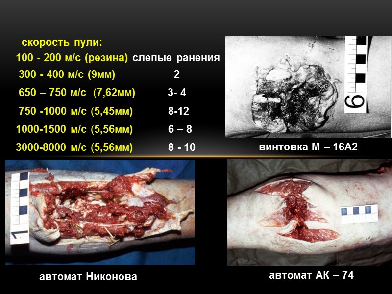 скорость пули:  100 - 200 м/с (резина) слепые ранения  300 - 400
